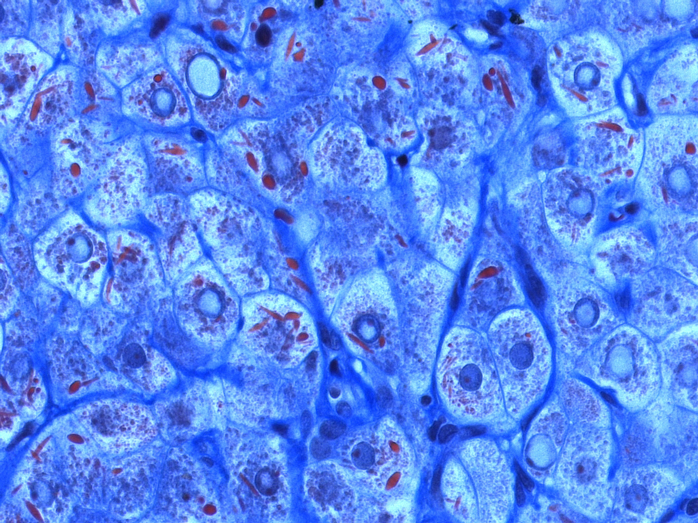 Стволовые клетки печени. Стволовые клетки микроскопия. Старение клетки. Клеточная трансплантация печени.